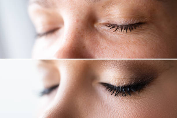 Woman Face Skin Make Up. Comparing Before And After